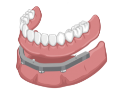 denturologie-image Denturologie Ranger