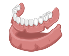 denturologie-ranger-image denturologie Ranger