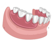 ranger-image Denturologie Ranger