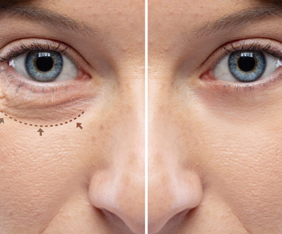 Pourquoi le marketing est indispensable pour une clinique de chirurgien esthétique ? Pourquoi le marketing est indispensable pour une clinique de chirurgien esthétique ?
