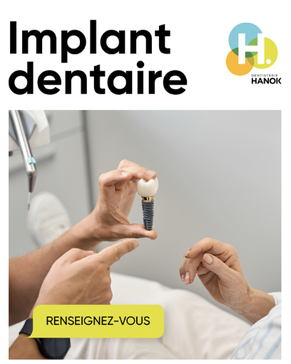 Hanok - Implant Dentaire Hanok - Implant Dentaire